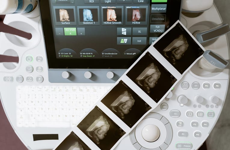 ஒற்றை ஃபோட்டான் வரைபடம்