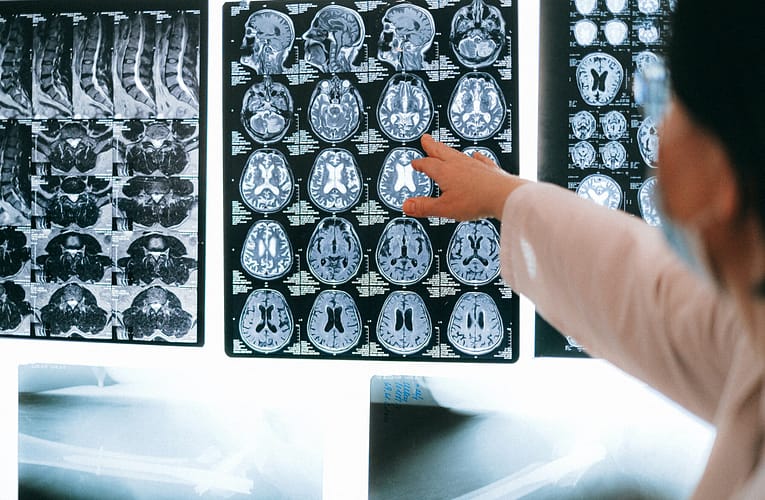 3D படங்களுக்கு எக்ஸ்ரே போன்ற கேமரா