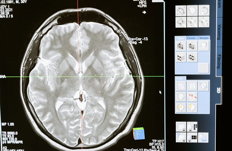 பெரிய அளவிலான கட்ட மீட்பு