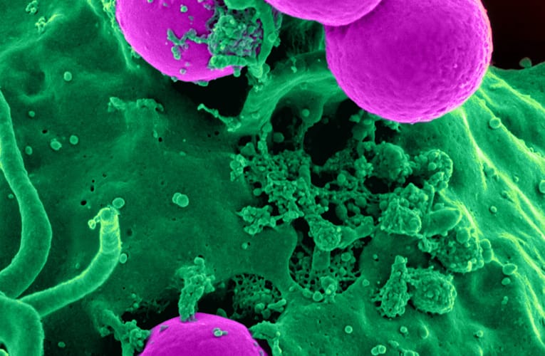 ஈஸ்ட் செல்கள் உட்பொதிக்கப்பட்ட பொருட்களில் விளைவது என்ன?