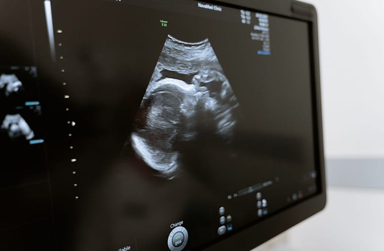 கர்ப்பத்திற்கான வாராந்திர வழிகாட்டி – வாரம் 16