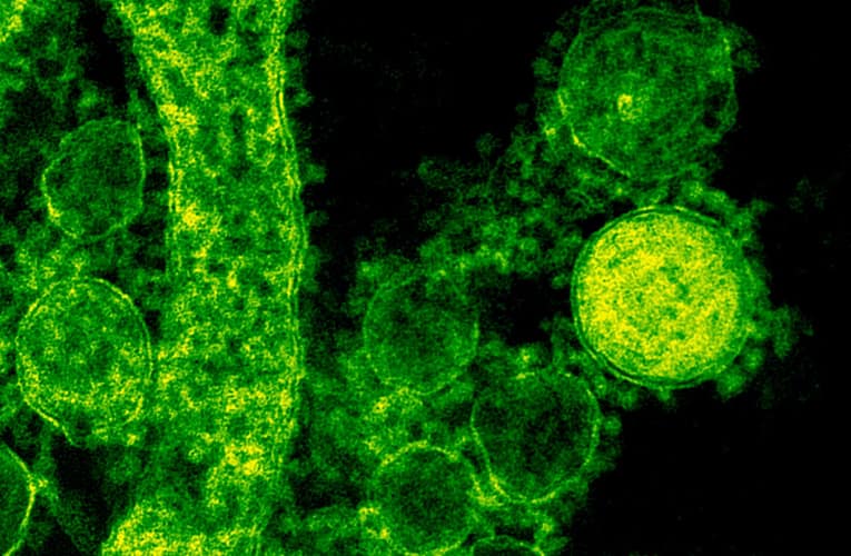 போலிப்படலப் பெருங்குடல் அழற்சி (Clostridioides Difficile Infection)