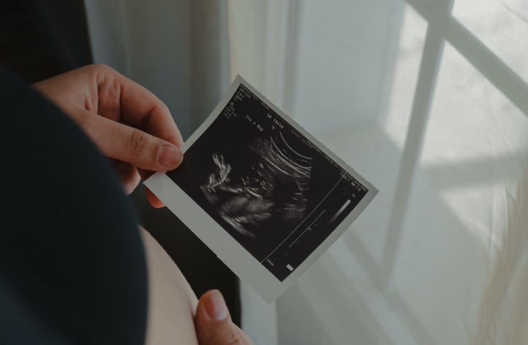 கர்ப்பத்திற்கான வாராந்திர வழிகாட்டி – வாரம் 35