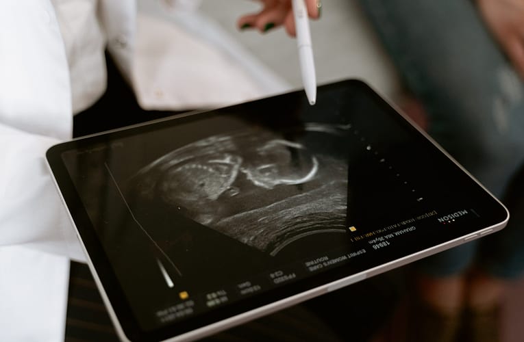 கர்ப்பத்திற்கான வாராந்திர வழிகாட்டி – வாரம் 34