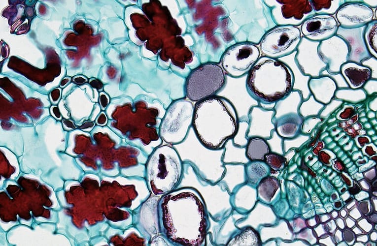 பக்கவாட்டு நுண்குமிழ்கள் புற்றுநோய் எதிர்ப்பு மருந்துகளை எடுத்துச் செல்லுதல் மற்றும் கட்டி நாளங்களை சேதப்படுத்துதல்