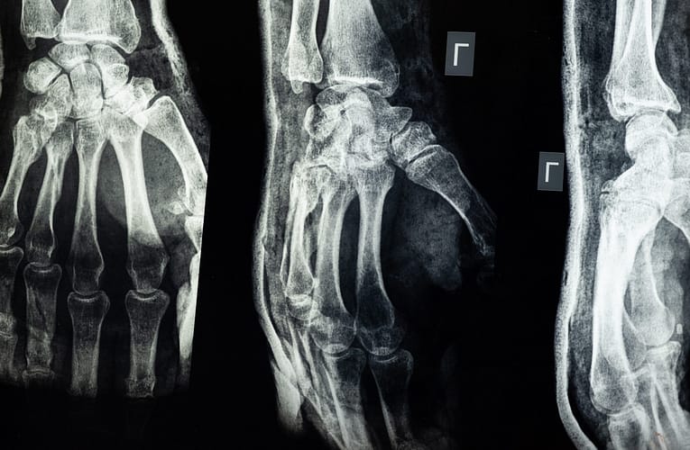 இயந்திர கற்றல் எக்ஸ்ரே துடிப்புகளின் மறைக்கப்பட்ட கூறுகளை வெளிப்படுத்துதல்