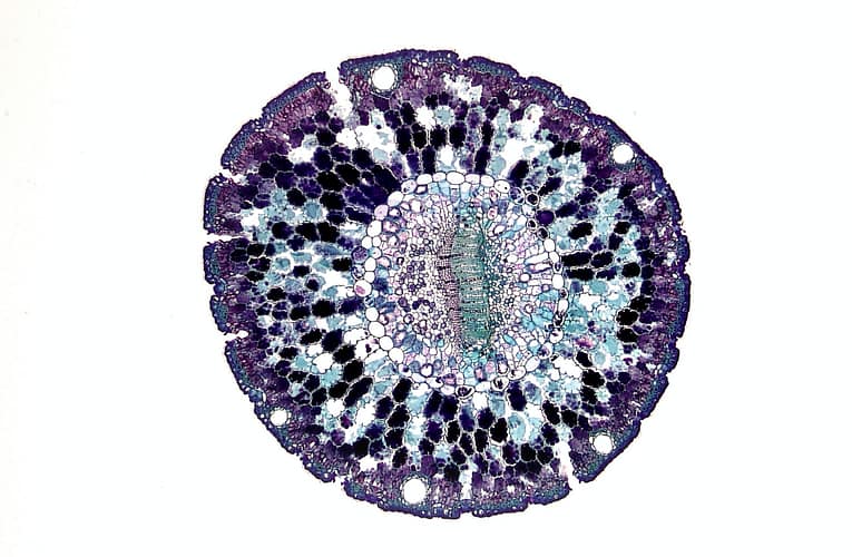 நடுக்குவாதம் (Parkinson’s disease)