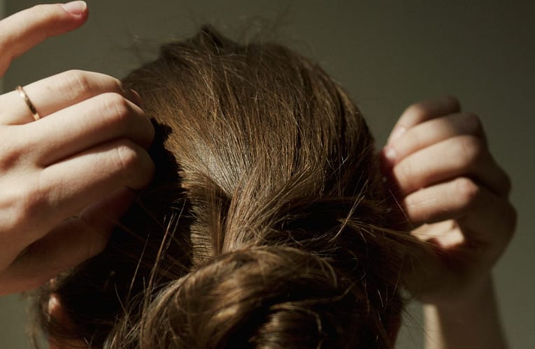 மச்சங்கள் (Moles)