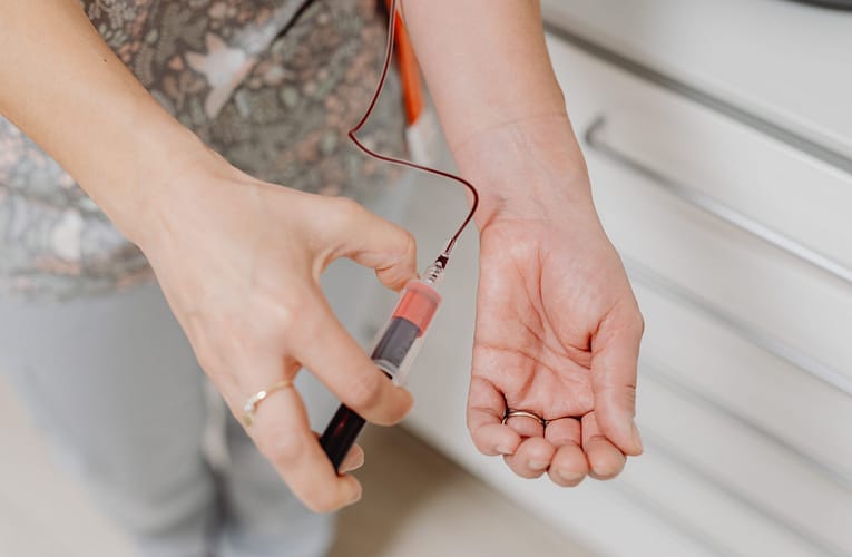 கால்சிஃபிலாக்ஸிஸ் (Calciphylaxis)