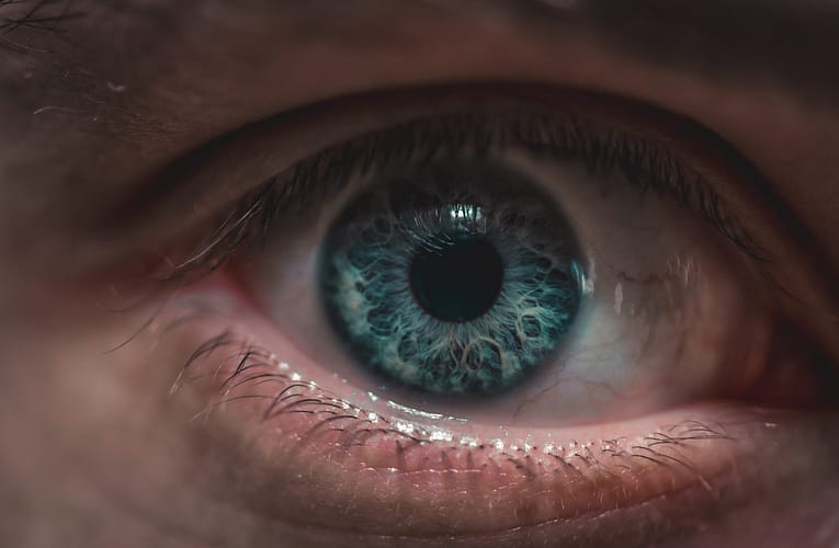 ஈரமான மாகுலர் சிதைவு (Wet Macular Degeneration)