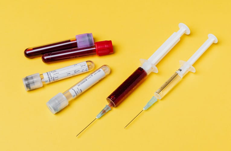 சிறுநீர்ப்பை அடைப்பு (Ureteral obstruction)