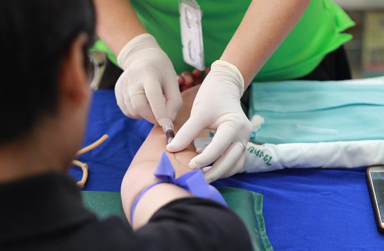 ராட்சத செல் தமனி அழற்சி (Giant Cell Arteritis)