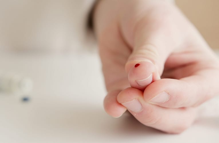 வி லைடன் பிறழ்வு காரணி (Factor V Leidon)